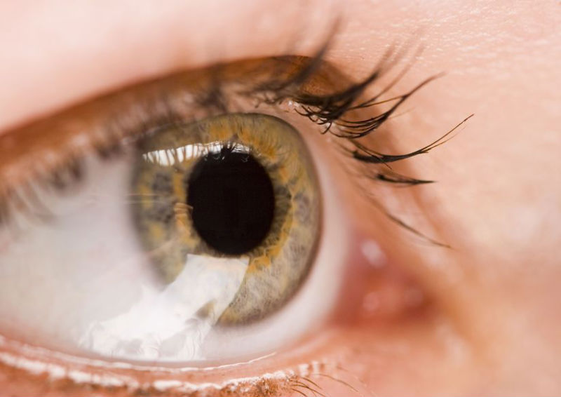 An Introduction to Dry Eye Syndrome Oahu