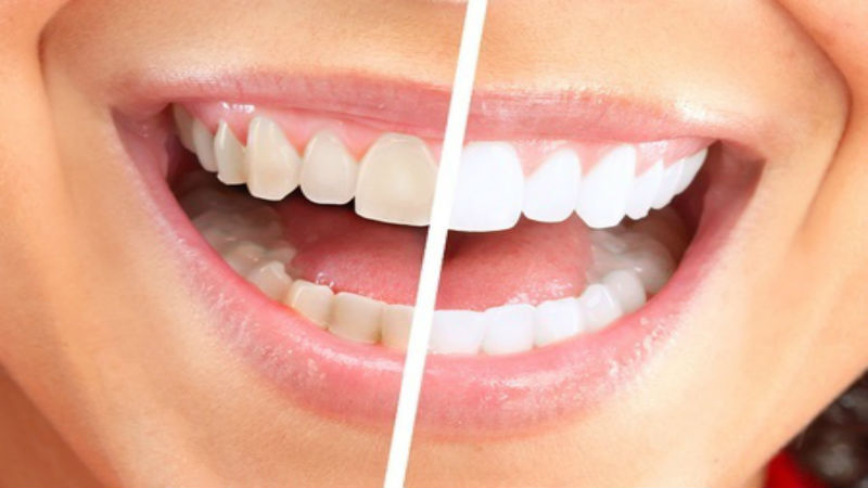 New York Implant Dentistry: Questions Answered
