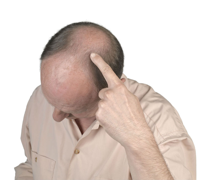 FUE Hair Transplant Philadelphia