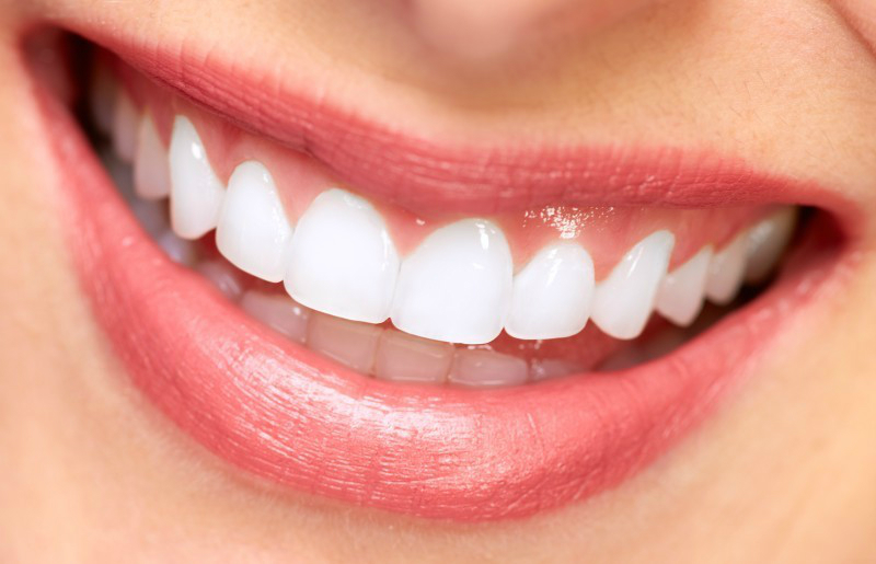 Make Teeth Whitening in Fairfield County CT Easy