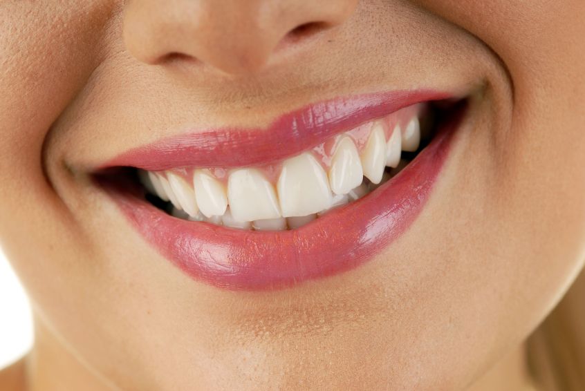 3 Different Ways Your Highland Park Dentist Can Restore Your Smile