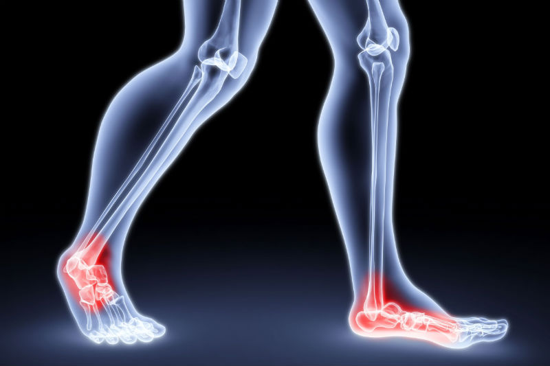 Pain Treatment in NC: What Are The 5 Symptoms of Arthritis And Joint Pain?