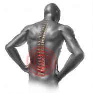 Patients Seeking Back Pain Treatment in Towson, MD Get Questions Answered