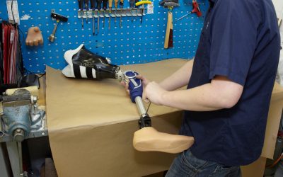 Embracing Independence With Prosthetic Limb Twin Falls ID Support and Expertise