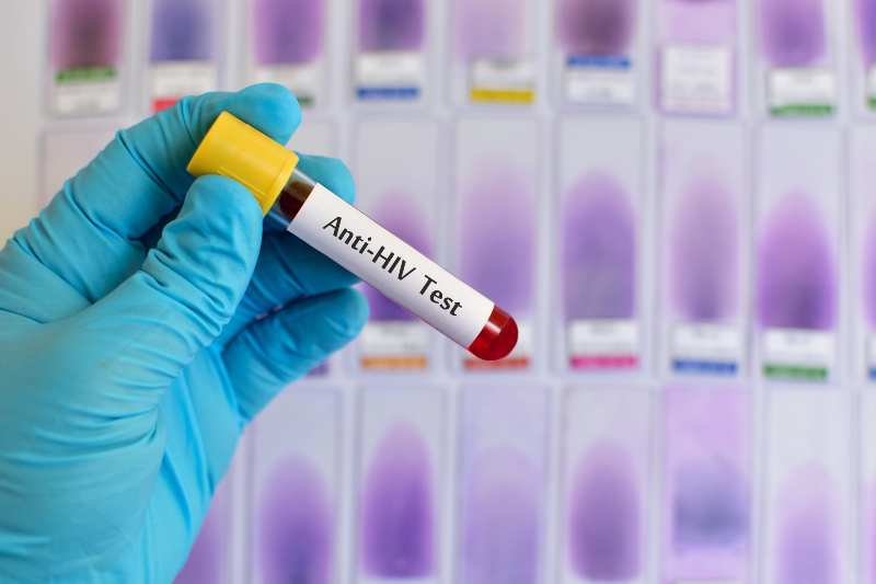 Confidentiality Matters When Choosing STD Testing – Avecina Medical in Orange Park, FL