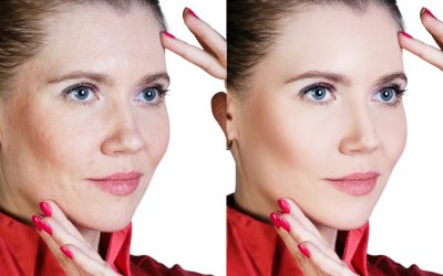 Achieve a Natural Youthful Look with a Sculptra Face Lift at Luxe Beauty & Wellness on Tomball Pkwy