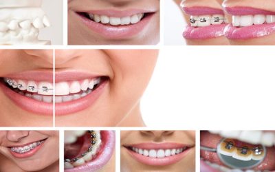 Enhance Confidence with Family Cosmetic Dentistry Southwest Edmonton Services