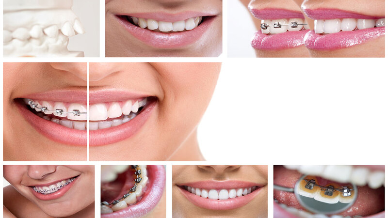 Enhance Confidence with Family Cosmetic Dentistry Southwest Edmonton Services