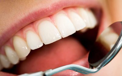 Achieving a Brighter Smile with Cosmetic Dental Care in Denver CO Made Simple