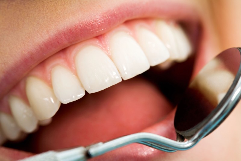 Achieving a Brighter Smile with Cosmetic Dental Care in Denver CO Made Simple