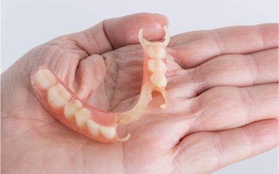 Achieve a Natural-Looking Smile by Choosing Dental Implants in Ridgewood, NY Experts